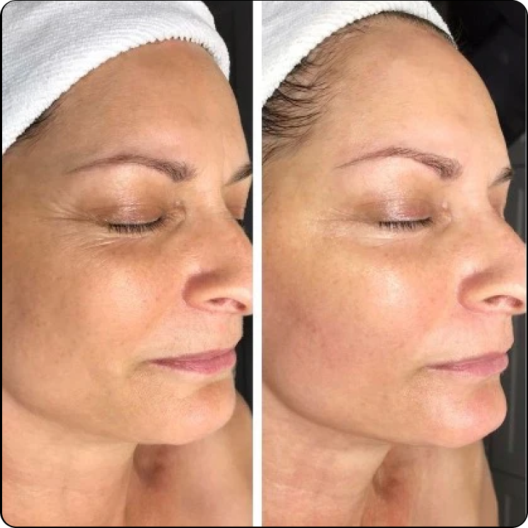 Jennifer using 168H & 48H Hydrating Cream